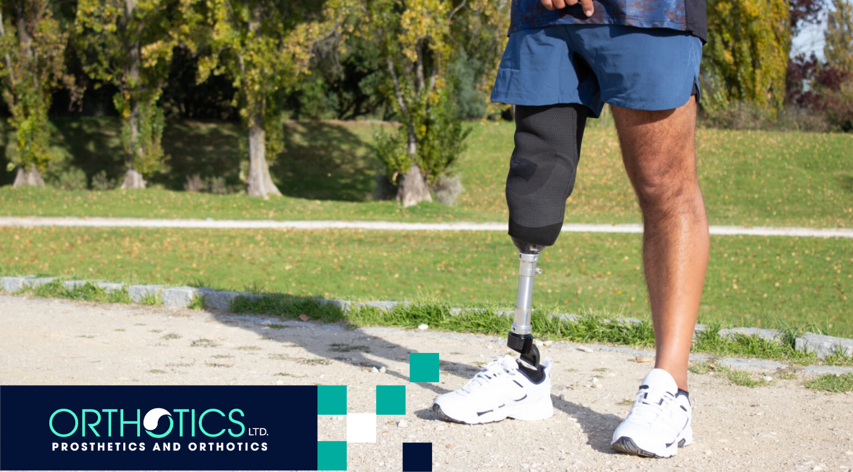 What Is a Prosthetic Limb? A Beginner’s Guide