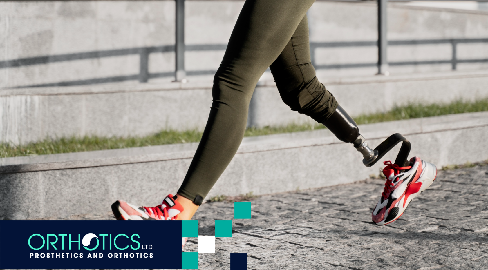Socket Technology in Prosthetics: Why It Matters