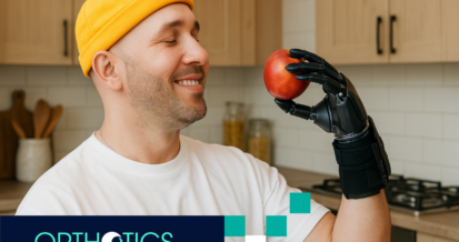 A man with an upper limb prosthetic is holding an apple