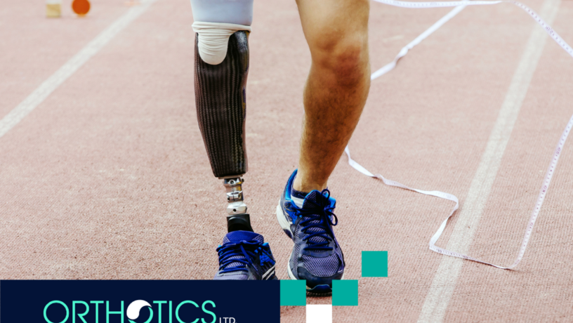1 Signs It’s Time to Replace Your Prosthetic Limb - featured An amputee with prosthetic legs running in a field