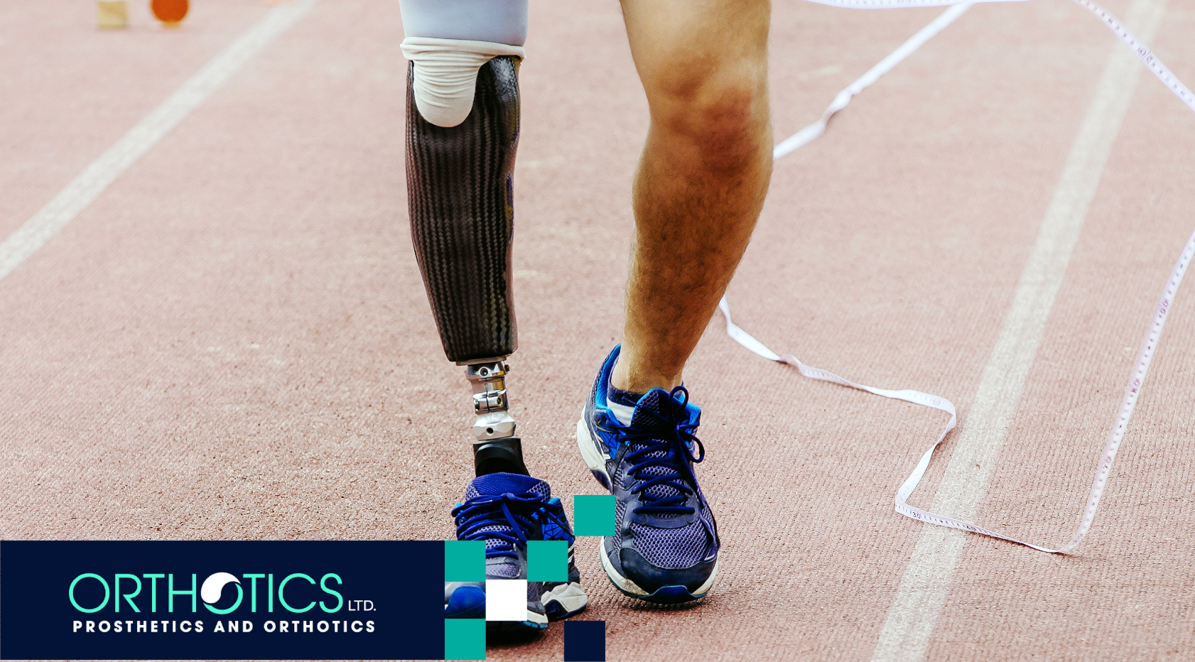 Signs It’s Time to Replace Your Prosthetic Limb