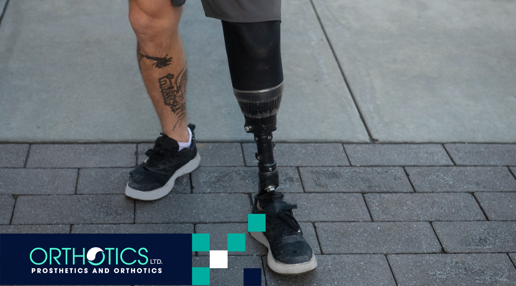 How Prosthetics Work: Understanding Functional Prosthetics