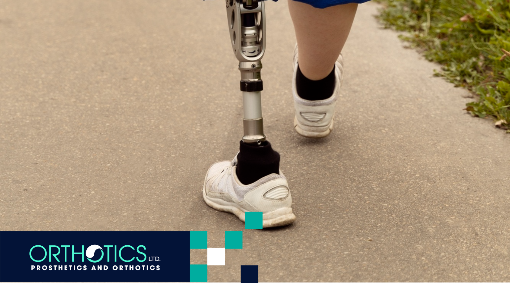 Cost of Prosthetic Limbs in 2025: Prices Explained