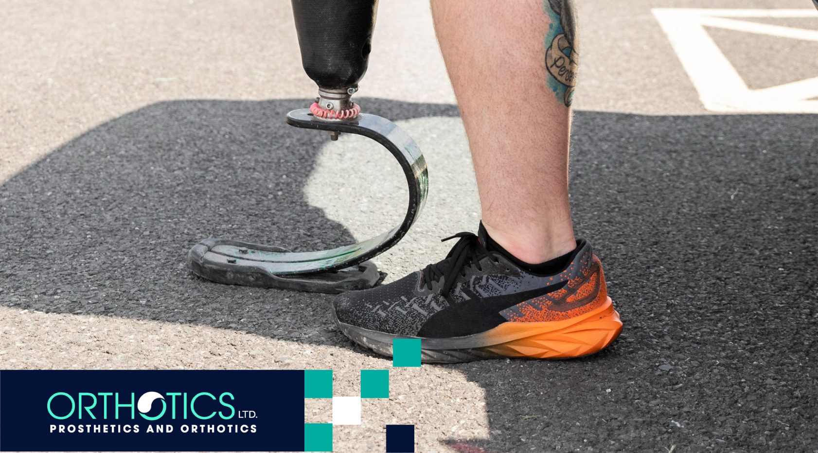 Hydraulic vs. Microprocessor Prosthetic Knees: Pros and Cons