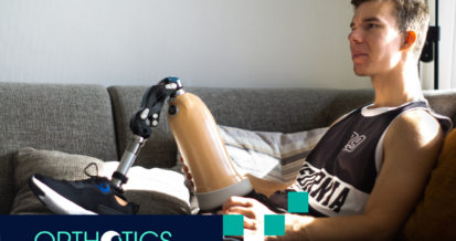 An amputee wearing prosthetics sitting on a couch