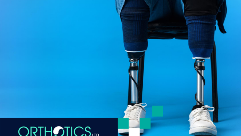 Top 5 Most Advanced Prosthetic Limbs in 2025 - featured An amputee wearing advanced prosthetics