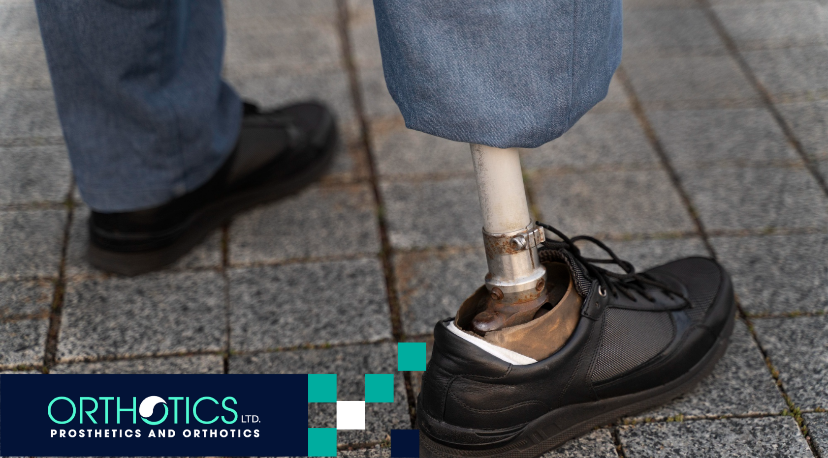 Debunking Common Myths About Prosthetic Limbs