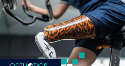 An amputee wearing a prosthetic riding a stationary bicycle